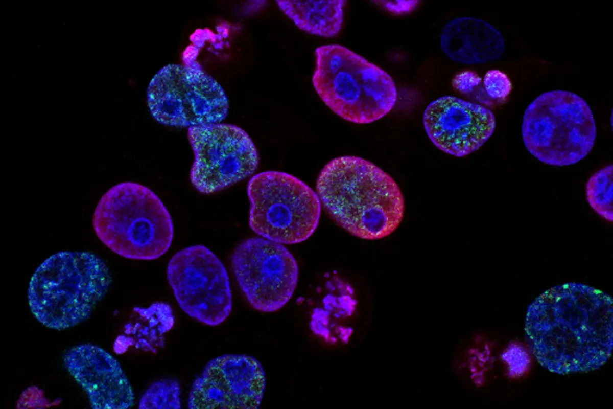 Expanding Global Access to Wockhardts Breakthrough Antibiotic Zaynich